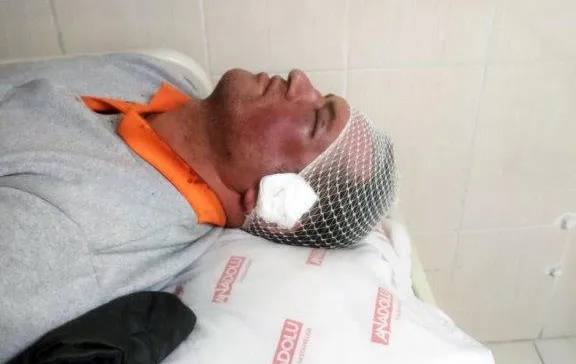 Temizlik işçisine kalleş saldırı… 